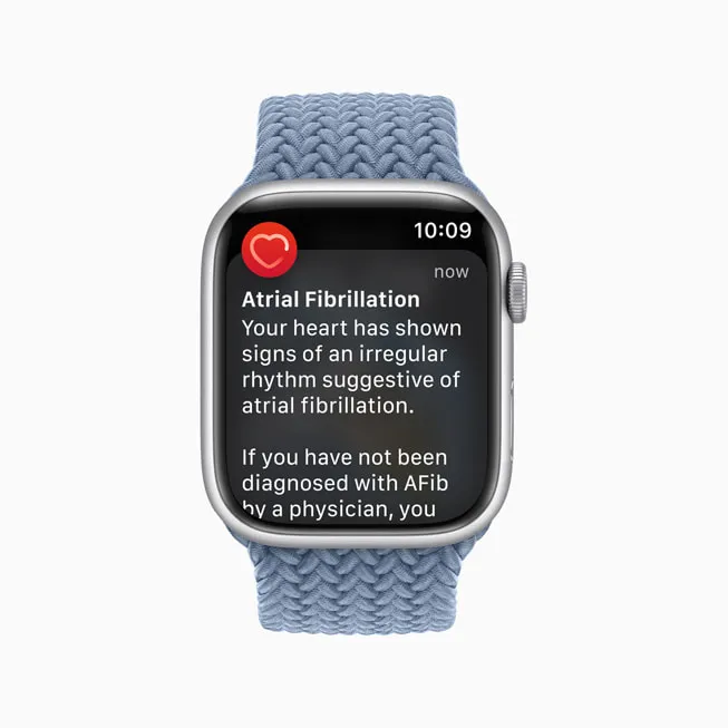 Apple Watch irregular rhythm notifications