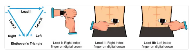 Apple Watch ECG positions