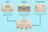 Medications can now lower cholesterol (ApoB) by 80%