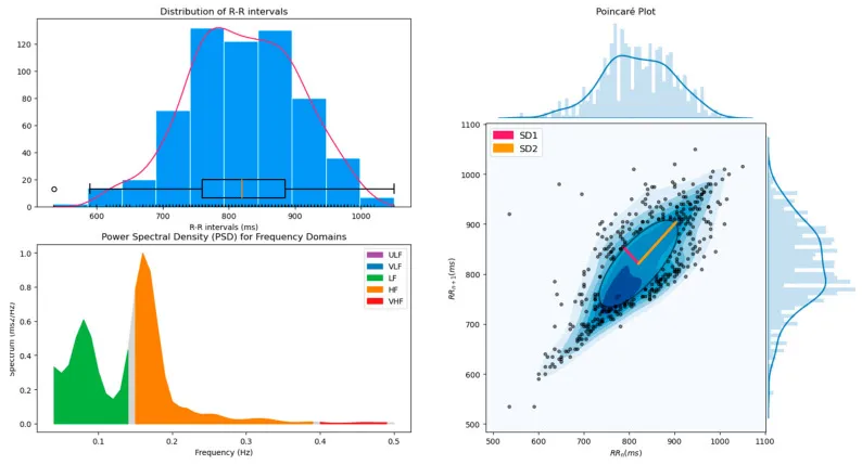 Every formula to measure HRV
