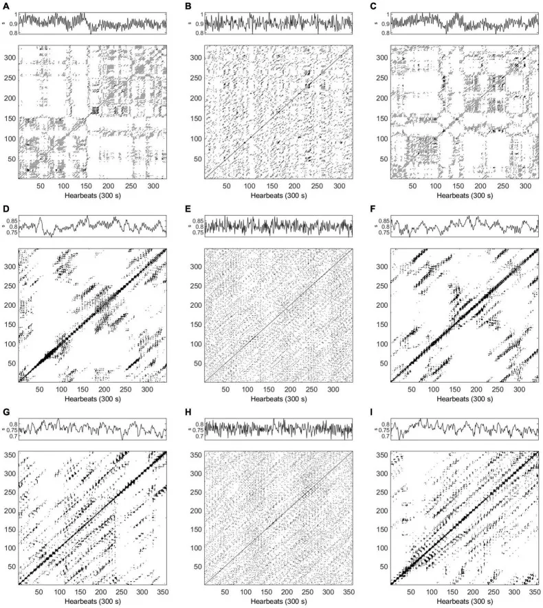 Recurrence plots of HRV for healthy subjects and ESRD patients