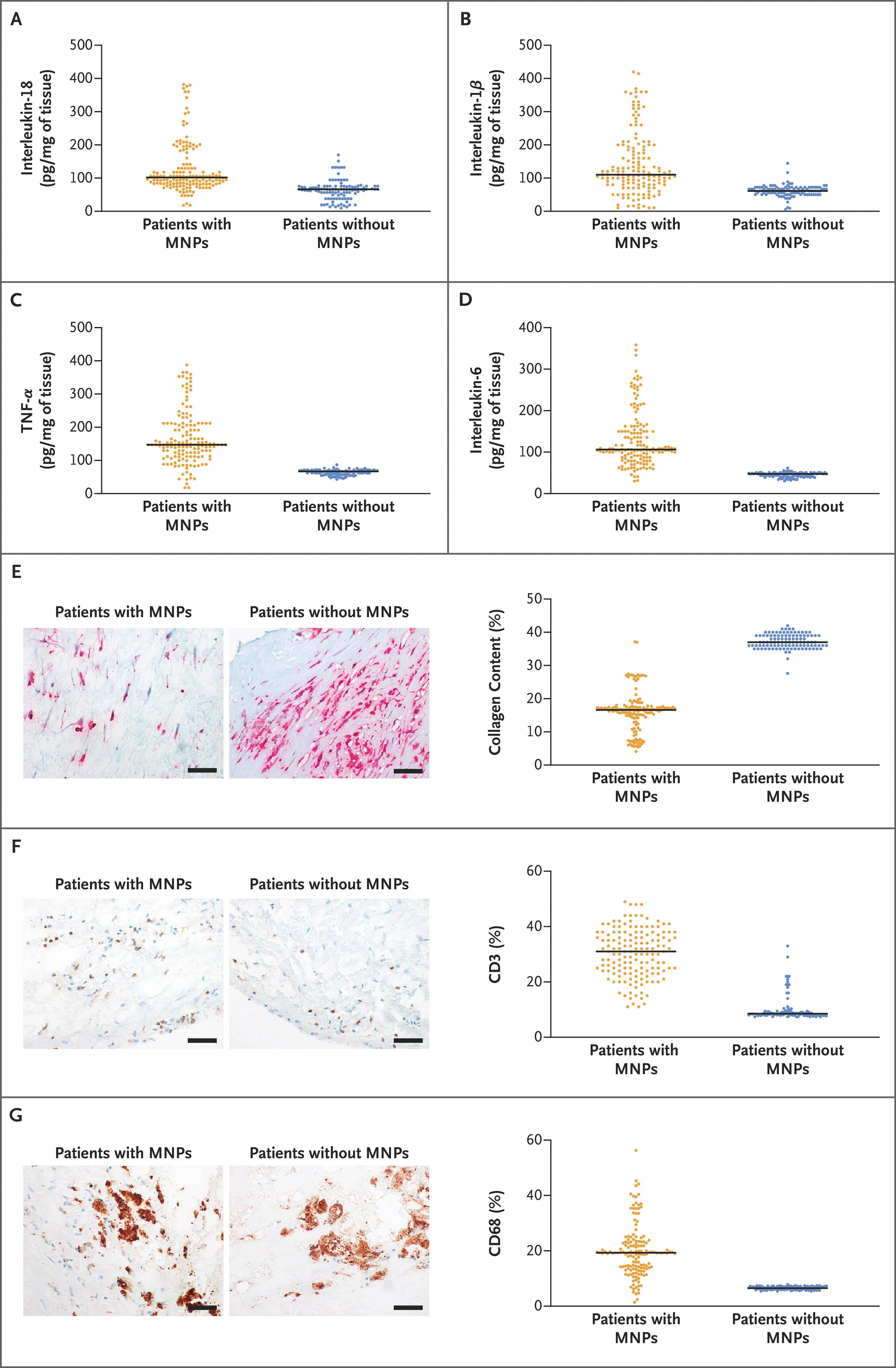 Inflammatory markers in plaque samples