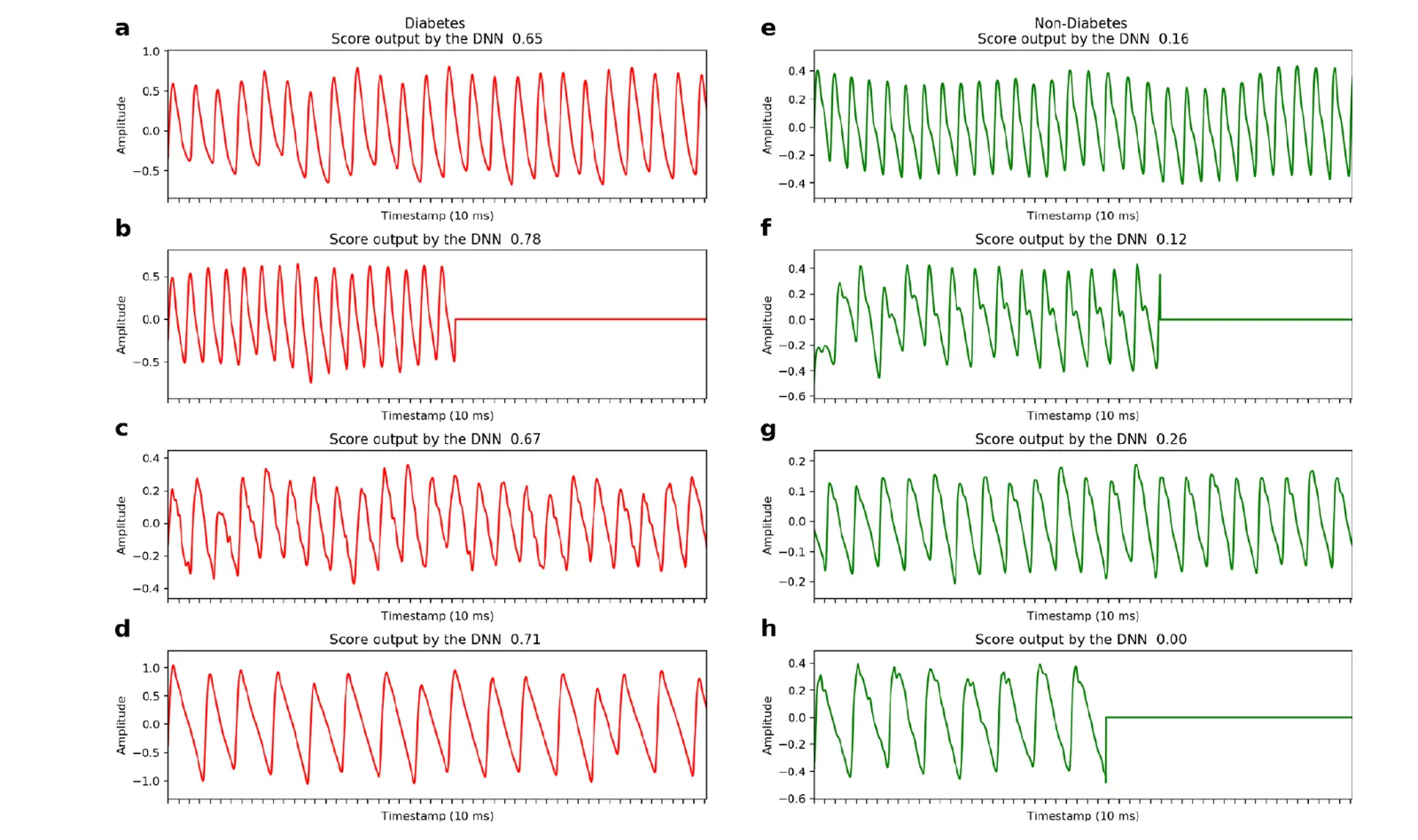 PPG waveforms from people with and without diabetes